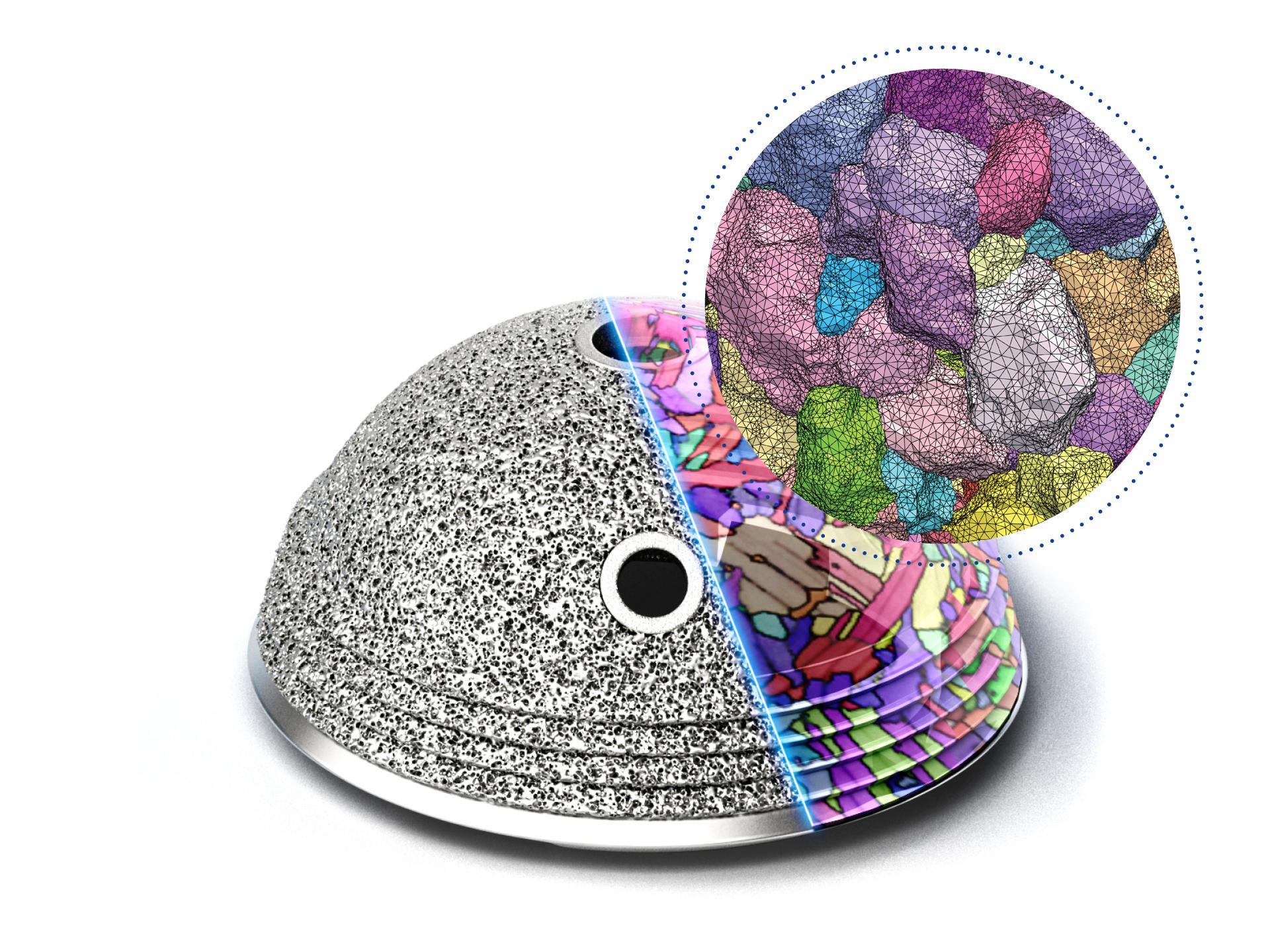 Post-Print Material Quality Inspection on Additively Manufactured Implants