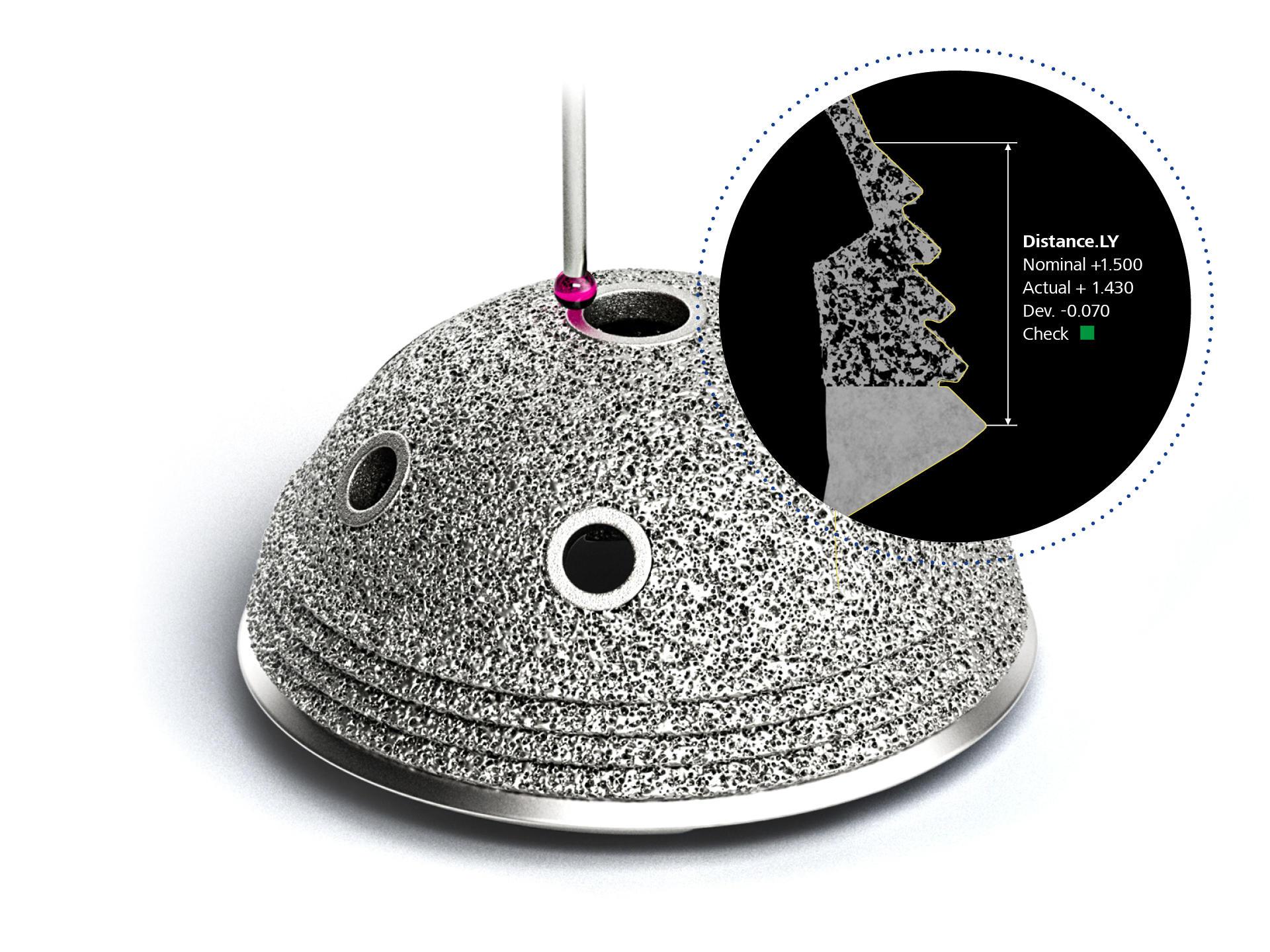 Dimensional control of highly complex 3D external geometries and internal structures/features of additively manufactured hip implants