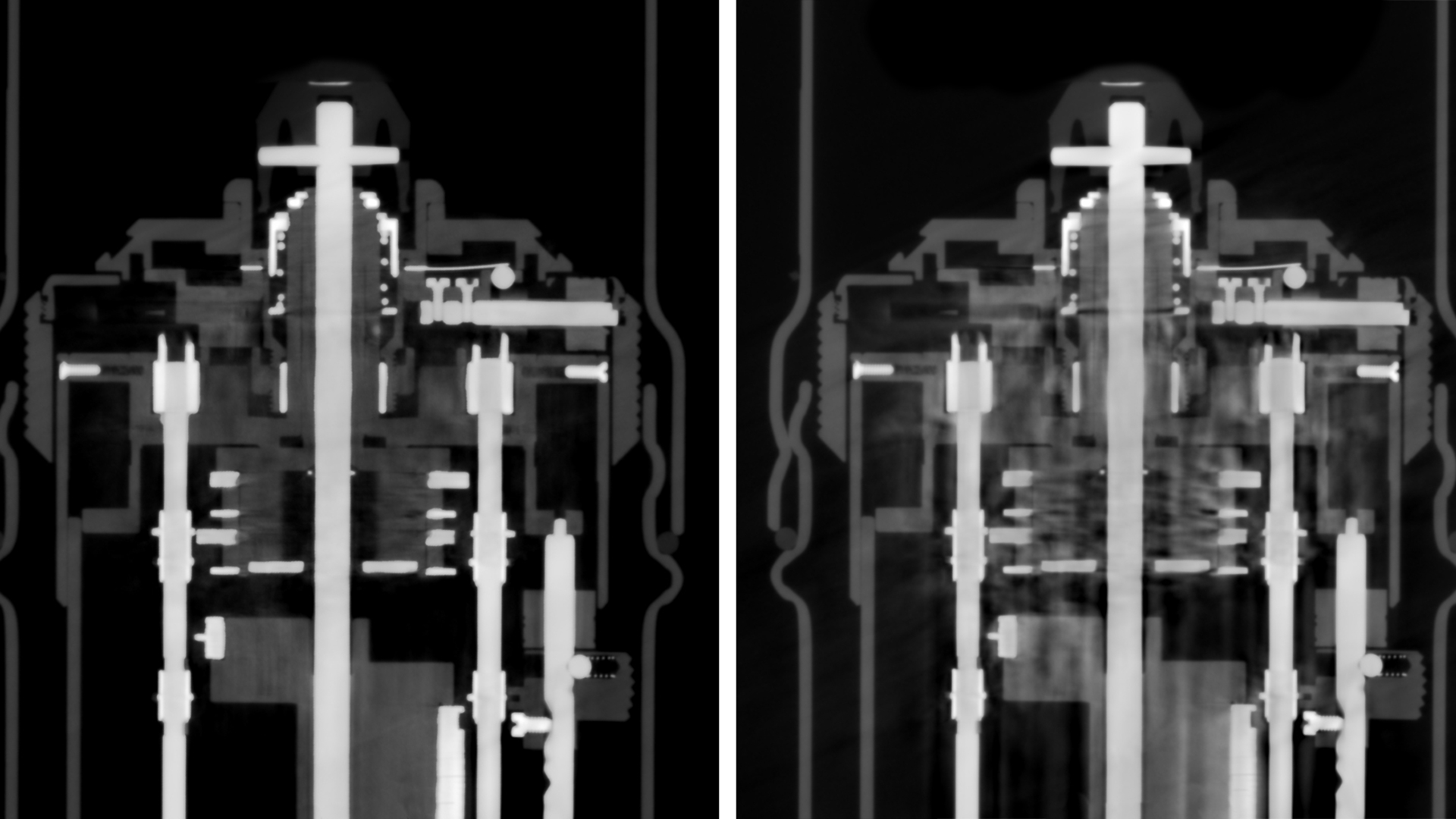 Advanced Mixed Material Artifact Reduction (AMMAR)​