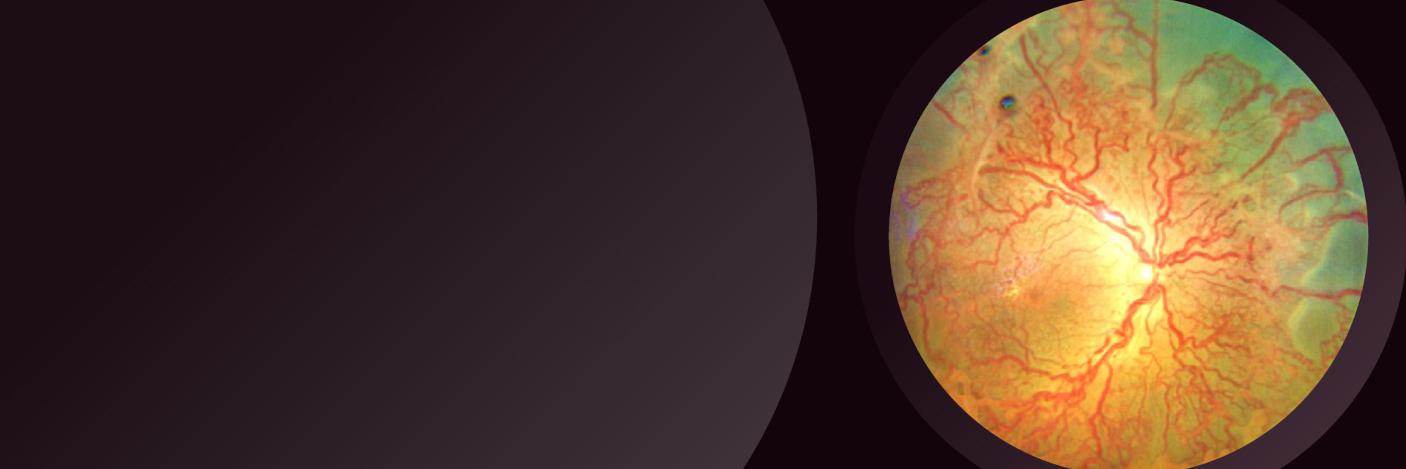 Expanding insights into the Retinopathy of Prematurity (ROP)